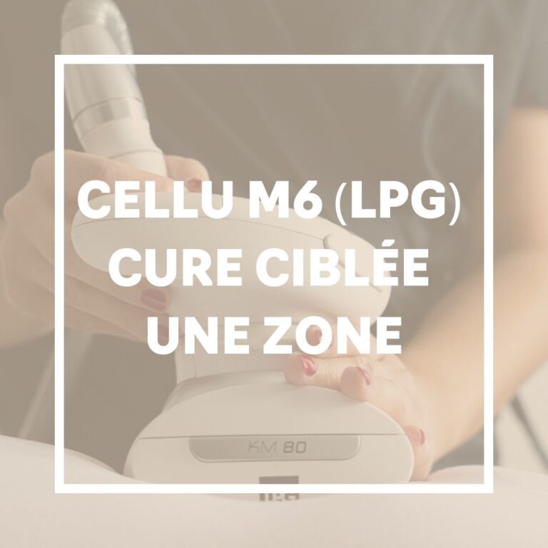 LPG-zone-ciblee